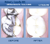 Smile Before and After